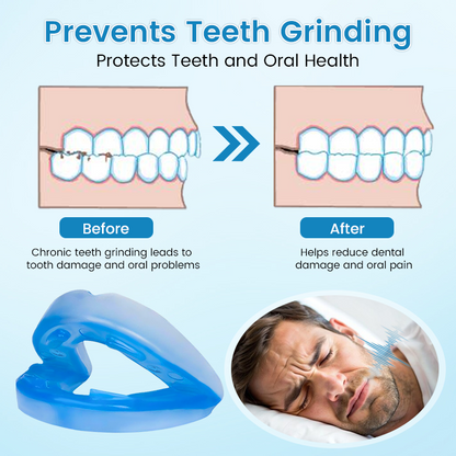 LAST DAY SALE 60% OFF⏰PerfectSleep Solution- Anti-Snoring & Anti-Grinding Teeth Protector-1