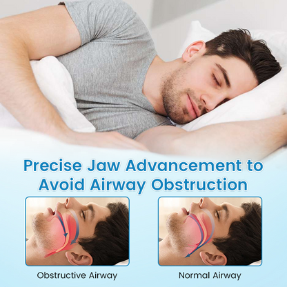 LAST DAY SALE 60% OFF⏰PerfectSleep Solution- Anti-Snoring & Anti-Grinding Teeth Protector-1